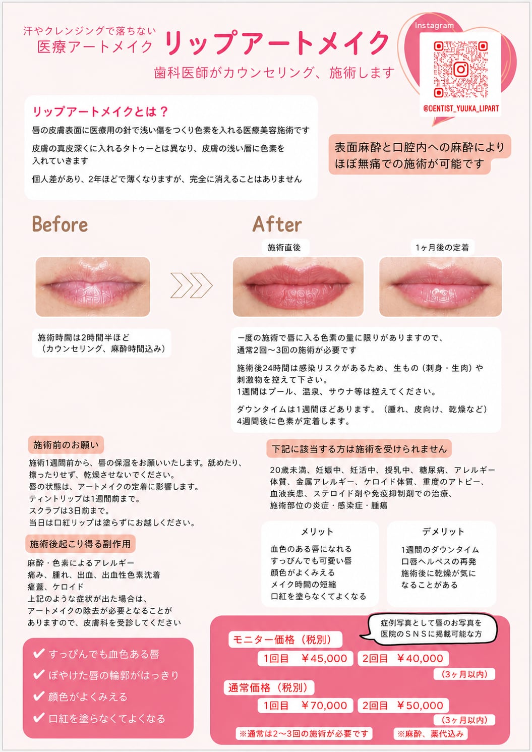 当院のリップアートメイク症例:施術前
